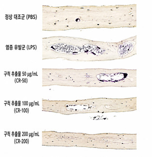 한약재 ‘구척 추출물’, 파골세포 형성·골 흡수 억제 기전 확인